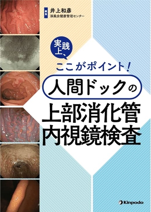 (中古品) 実践上、ここがポイント！　人間ドックの上部消化管内視鏡検査