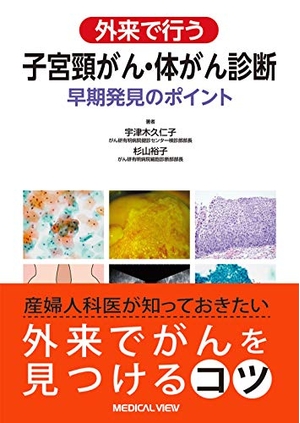 (中古品) 外来で行う 子宮頸がん・体がん診断−早期発見のポイント