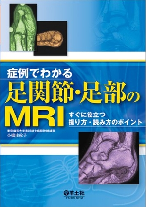 (中古品) 症例でわかる足関節・足部のMRI〜すぐに役立つ撮り方・読み方のポイント