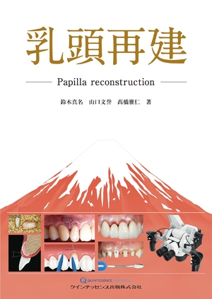 (中古品) 乳頭再建: Papilla reconstruction