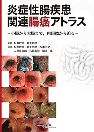 (中古品) 炎症性腸疾患関連腸癌アトラスー小腸から大腸まで, 肉眼像から迫るー 10,467円