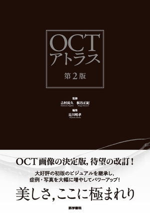 (中古品) OCTアトラス 第2版