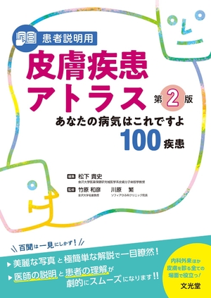 (中古品) 患者【商品説明】用 皮膚疾患アトラス 第2版: あなたの病気はこれですよ100疾患