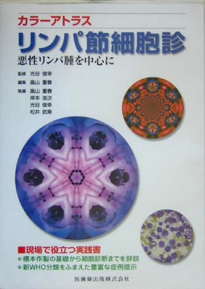 (中古品) リンパ節細胞診: 悪性リンパ腫を中心に