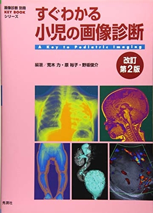 (中古品) すぐわかる小児の画像診断 改訂第2版 (画像診断別冊KEYBOOKシリーズ) 10,640円