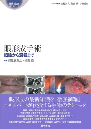 (中古品) 眼形成手術: 眼瞼から涙器まで (眼科臨床エキスパート)