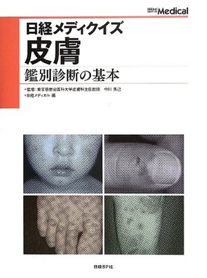 (中古品) 日経メディクイズ 皮膚 鑑別診断の基本