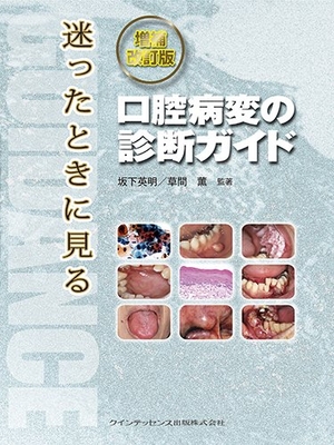 (中古品) 増補改訂版 迷ったときに見る口腔病変の診断ガイド