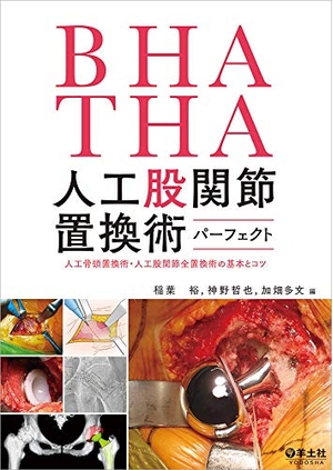 (中古品) BHA・THA 人工股関節置換術パーフェクト〜人工骨頭置換術・人工股関節全置換術の基本とコツ
