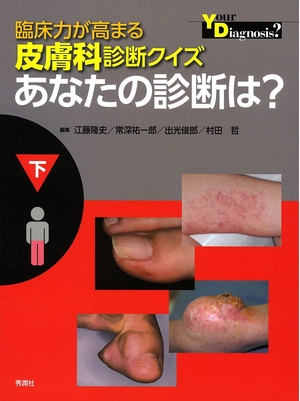 (中古品) 臨床力が高まる皮膚科診断クイズ 下