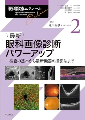 (中古品) 最新 眼科画像診断パワーアップ (眼科診療エクレール 2)