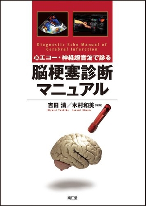 (中古品) 心エコー・神経超音波で診る脳梗塞診断マニュアル