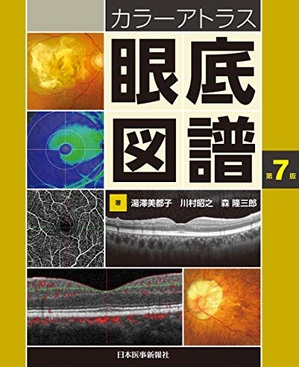 (中古品) カラーアトラス眼底図譜