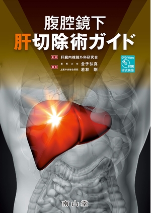 (中古品) 腹腔鏡下肝切除術ガイド: DVD-Video付属(術式映像)