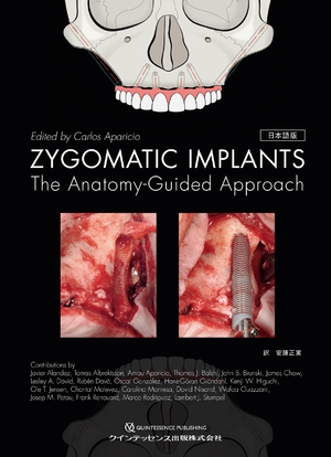 (中古品) ZYGOMATIC IMPLANTS 日本語版: The Anatomy-Guided Approach