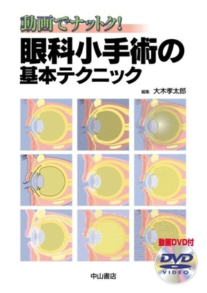 (中古品) 眼科小手術の基本テクニック—動画でナットク!