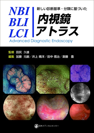 (中古品) 新しい診断基準・分類に基づいたNBI/BLI/LCI内視鏡アトラス