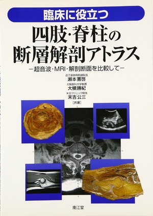 (中古品) 臨床に役立つ四肢・脊柱の断層解剖アトラス
