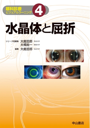 (中古品) 水晶体と屈折 (眼科診療ビジュアルラーニング)