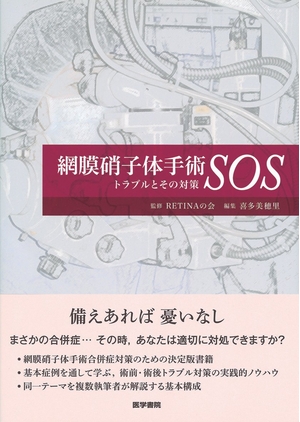 (中古品) 網膜硝子体手術SOS—トラブルとその対策