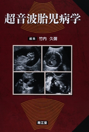 (中古品) 超音波胎児病学
