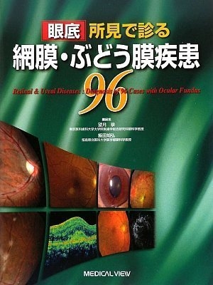 (中古品) 眼底所見で診る 網膜・ぶどう膜疾患96