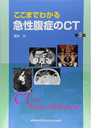 (中古品) ここまでわかる急性腹症のCT 第3版