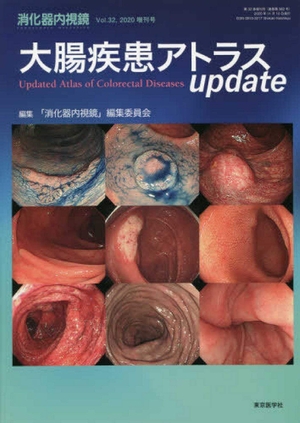 (中古品) 消化器内視鏡 (Vol.32(2020 増刊号))