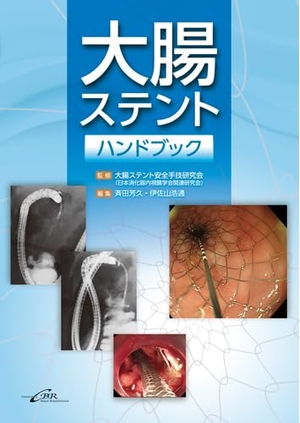 (中古品) 結腸ステント商品目録