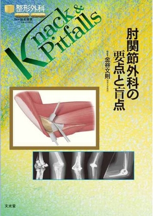 (中古品) 肘関節外科の要点と盲点 (整形外科knack & pitfalls)