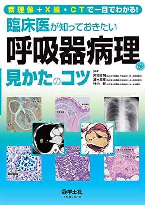 (中古品) 病理像＋X線・CTで一目でわかる！ 臨床医が知っておきたい呼吸器病理の見かたのコツ