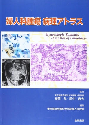 (中古品) 婦人科腫瘍病理アトラス 7,637円
