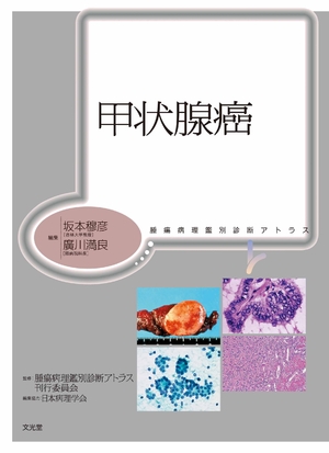 (中古品) 甲状腺癌 (腫瘍病理鑑別診断アトラス) 9,745円
