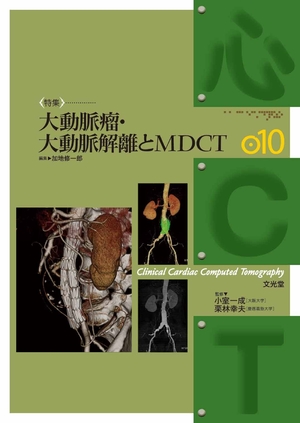 (中古品) 大動脈瘤・大動脈解離とMDCT (心CT 10)