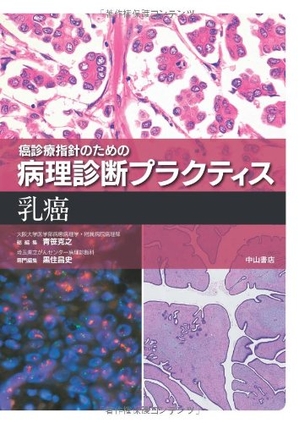 (中古品) 乳癌 (癌診療指針のための病理診断プラクティス)