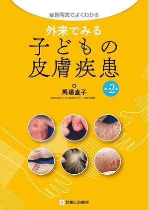 (中古品) 症例写真でよくわかる 外来でみる子どもの皮膚疾患 改訂第2版