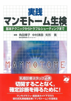 (中古品) 実践マンモトーム生検—基本テクニックからトラブルシューティングまで