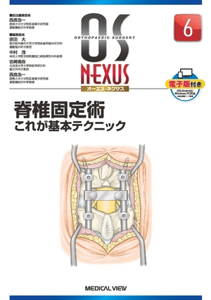 (中古品) 脊椎固定術−これが基本テクニック (OS NEXUS(電子版付き) 6)