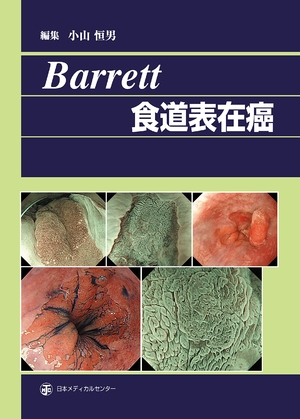(中古品) Barrett食道表在癌