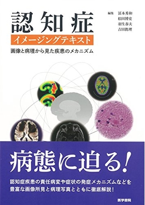 (中古品) 認知症イメージングテキスト: 画像と病理から見た疾患のメカニズム 10,850円