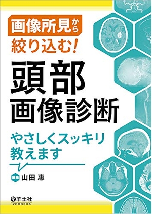 (中古品) 画像所見から絞り込む! 頭部画像診断やさしくスッキリ教えます