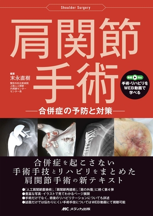 (中古品) 肩関節手術: 合併症の予防と対策