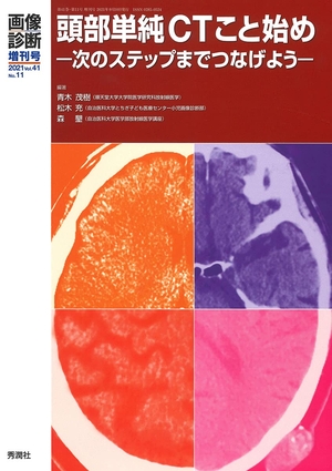 (中古品) 画像診断２０２１年増刊号Ｖｏｌ．４１　Ｎｏ．１１ (画像診断増刊号)