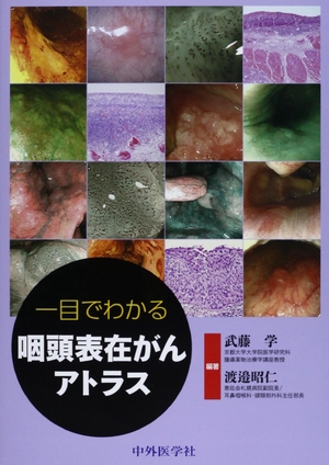 (中古品) 一目でわかる咽頭表在がんアトラス