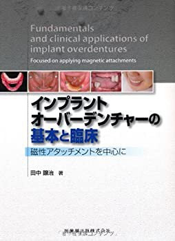 インプラントオーバーデンチャーの基本と臨床磁性アタッチメントを中心に(未使用 未開封の中古品)の通販は