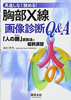 見逃しなく読める!胸部X線画像診断Q&A—「人の肺」読影法と症例演習(未使用 未開封の中古品)