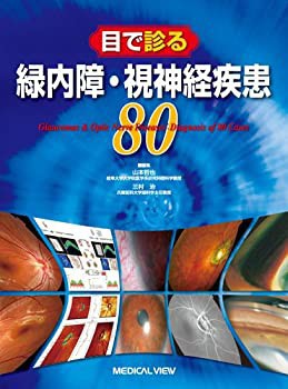正規品販売！ 目で診る緑内障・視神経疾患80(未使用 未開封の中古品) 医学一般