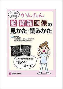 ナースのための かんたん脳・脊髄画像の見かた・読みかた(中古品)の通販は 6,645円
