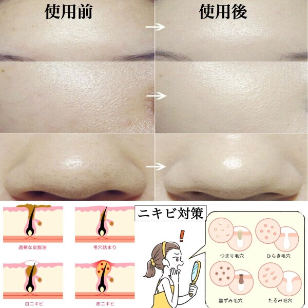 Elvi Grace 洗顔ブラシ 熊野筆 (竹宝堂）濃密泡 毛穴 無添加 敏感肌 乾燥肌 保湿 黒ずみ くすみ 皮脂 レディース メンズ スキンケア プレゼント ギフト 日本製 Elvi Grace 洗顔ブラシ 熊野筆 (竹宝堂）濃密泡 毛穴 無添加 敏感肌