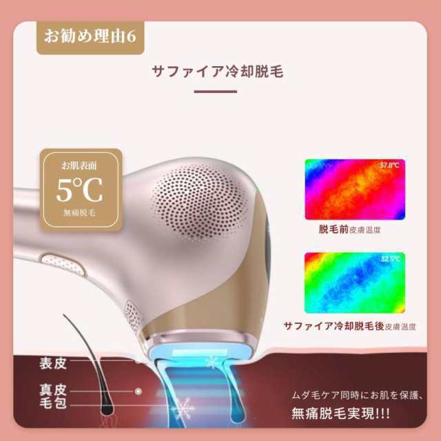 脱毛器 永久脱毛 IPL光脱毛器 VIO脱毛 フラッシュ脱毛器 冷却 全身脱毛